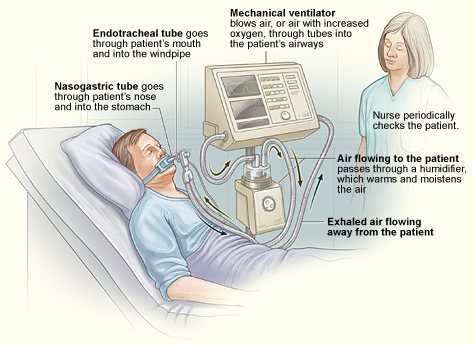 Ventilators